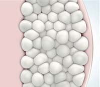 coolsculpting clinic gold coast|CoolSculpting® .